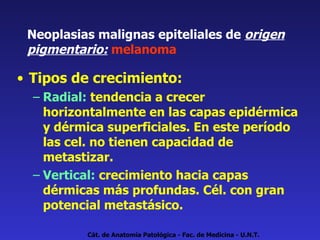 Neoplasias malignas epiteliales de  origen pigmentario:   melanoma  Tipos de crecimiento: Radial:  tendencia a crecer horizontalmente en las capas epidérmica y dérmica superficiales. En este período las cel. no tienen capacidad de metastizar.  Vertical:  crecimiento hacia capas dérmicas más profundas. Cél. con gran potencial metastásico. Cát. de Anatomía Patológica - Fac. de Medicina - U.N.T. 