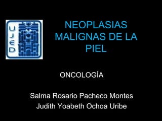 NEOPLASIAS
MALIGNAS DE LA
PIEL
ONCOLOGÍA
Salma Rosario Pacheco Montes
Judith Yoabeth Ochoa Uribe
 