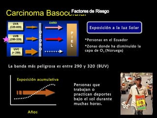 Exposición a la luz SolarExposición a la luz SolarExposición a la luz SolarExposición a la luz Solar
Carcinoma BasocelularCarcinoma Basocelular
La banda más peligrosa es entre 290 y 320 (BUV)
*Personas en el Ecuador
*Zonas donde ha disminuido la
capa de O3 (Noruega)
Exposición acumulativa
AñosAños
Personas que
trabajan o
practican deportes
bajo el sol durante
muchas horas.
 