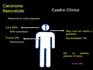 CarcinomaCarcinoma
BasocelularBasocelular Cuadro Clínico
Predomina en zonas expuestas
Cara 94%
82% centrofacial
Tronco 5%
Multicentrico
Muy raro en cuello y
genitales
Extremidades 1%
No en palmas,
plantas ni boca.
5 mm/ año.
 