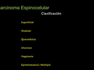 ClasificaciónClasificación
Carcinoma EspinocelularCarcinoma Espinocelular
SuperficialSuperficial
NodularNodular
QueratósicoQueratósico
UlcerosoUlceroso
VegetanteVegetante
Epiteliomatosis MúltipleEpiteliomatosis Múltiple
 