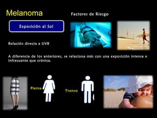 Exposición al SolExposición al SolExposición al SolExposición al Sol
MelanomaMelanoma Factores de RiesgoFactores de Riesgo
Relación directa a UVB
A diferencia de los anteriores, se relaciona más con una exposición intensa e
infrecuente que crónica.
Pierna
Tronco
 