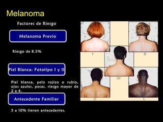 Melanoma PrevioMelanoma PrevioMelanoma PrevioMelanoma Previo
MelanomaMelanoma
Factores de RiesgoFactores de Riesgo
Riesgo de 8.5%
Piel Blanca: Fototipo I y IIPiel Blanca: Fototipo I y IIPiel Blanca: Fototipo I y IIPiel Blanca: Fototipo I y II
Piel blanca, pelo rojizo o rubio,
ojos azules, pecas. riesgo mayor de
2 a 4.
Antecedente FamiliarAntecedente FamiliarAntecedente FamiliarAntecedente Familiar
5 a 10% tienen antecedentes.
 