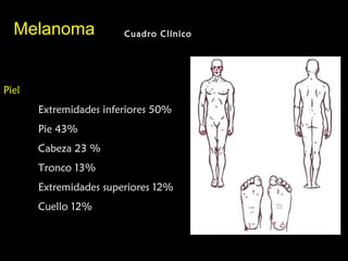 MelanomaMelanoma Cuadro ClínicoCuadro Clínico
Piel
Extremidades inferiores 50%
Pie 43%
Cabeza 23 %
Tronco 13%
Extremidades superiores 12%
Cuello 12%
 