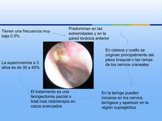 Predominan en las
Tienen una frecuencia muy
                                    extremidades y en la
baja 0.5%
                                    pared torácica anterior

                                                        En cabeza y cuello se
                                                        originan principalmente del
                                                        plexo braquial o las ramas
La supervivencia a 3                                    de los nervios craneales
años es de 30 a 40%




               El tratamiento es una                  En la laringe pueden
               laringectomia parcial o                iniciarse en los nervios
               total mas radioterapia en              laríngeos y aparecer en la
               cazos avanzados                        región supraglotica
 