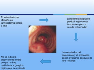 El tratamiento de
                              La radioterapia puede
elección es
                              producir regresiones
laringectomia parcial
                              temporales pero no
o total
                              cura la enfermedad




                          Los resultados del
                          tratamiento y el pronostico
No se indica la           deben evaluarse después de
disección del cuello      10 o 15 años
porque no hay
metástasis a ganglios
regionales, se extiende
 