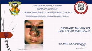 NEOPLASIAS MALIGNAS DE
NARIZ Y SENOS PARANASALES
UNIVERSIDAD AUTONOMA DE SINALOA
HOSPITAL CIVIL DE CULIACAN
CENTRO DE INVESTIGACIÓN Y DOCENCIA EN CIENCIAS DE LA SALUD
OTORRINOLARINGOLOGIA Y CIRUGIA DE CABEZA Y CUELLO
DR. ANGEL CASTRO URQUIZO
R2 ORL
CULIACAN SINALOA
AGOSTO 2017
 