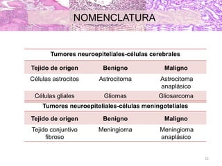NOMENCLATURA
12
Tumores neuroepiteliales-células cerebrales
Tejido de origen Benigno Maligno
Células astrocitos Astrocitoma Astrocitoma
anaplásico
Células gliales Gliomas Gliosarcoma
Tumores neuroepiteliales-células meningoteliales
Tejido de origen Benigno Maligno
Tejido conjuntivo
fibroso
Meningioma Meningioma
anaplásico
 