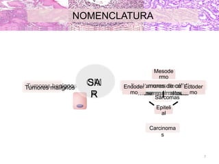 NOMENCLATURA
Tumores benignos OM
A
Los tumores de células
mesenquimatosas
Tumores malignos Los tumores de células
mesenquimatosas
SA
R Sarcomas
Epiteli
al
Endoder
mo
Mesode
rmo
Ectoder
mo
Carcinoma
s
7
 