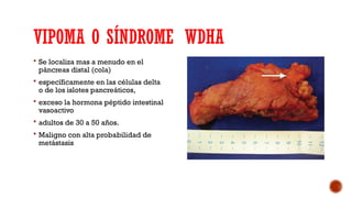 Comprehensive Overview of Pancreatic Neoplasms: Endocrine and Exocrine ...