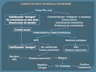 CONDUCTA ANTE UN NÓDULO PULMONAR

Tórax PA y Lat.
Calcificación “benigna”
No crecimiento en dos años
Disminución de tamaño

Características “malignas” o dudosas
Tumor previo
Calcificación excéntrica
Evidencia de crecimiento

Control anual
TOMOGRAFÍA COMPUTARIZADA
NPS
Calcificación “benigna”

Benigna
Alto

Nódulos múltiples
No calcificado
Calcio excéntrico

Biopsia aspiración
Negativo
Cirugía

Alto
Biopsia aspiración

Maligna
TC. Estadiaje

Positivo
Tratamiento

 
