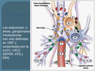 Las estaciones, o
áreas, ganglionares
intratorácicas
han sido definidas
en 1997 y
sustentadas por la
AJCC, UICC,
SEPAR, ATS y
ERS.

 