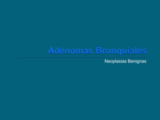 Neoplasias Benignas

 