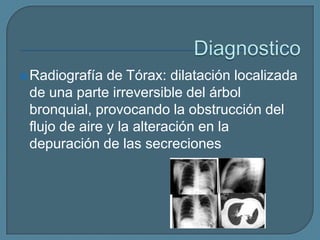  Radiografía

de Tórax: dilatación localizada
de una parte irreversible del árbol
bronquial, provocando la obstrucción del
flujo de aire y la alteración en la
depuración de las secreciones

 
