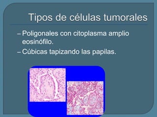 – Poligonales con citoplasma amplio

eosinófilo.
– Cúbicas tapizando las papilas.

 