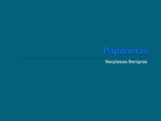 Neoplasias Benignas

 
