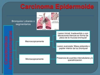 Caracteristicas
Anatomopatologicas

Bronquios Lobares o
segmentarios

Lesion Inicial: Inadevertido o con
elevaciones blancas en forma de
placa de la mucosa bronquial
Macroscopicamente
Lesion avanzada: Masa polipoide o
papilar interior de luz bronquial

Microscopicamente

Presencia de puentes intercelulares y/o
queratinizacion

 