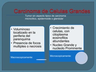 Tumor sin aspecto tipico de carcinoma
microcitico, epidermoide o glandular

• Voluminoso
localizado en la
periferia del
parenquima
• Presencia de focos
multiples o necrosis

Macroscopicamente:

• Crecimiento de
celulas, con
citoplasma
eosinofilos
abundantes
• Nucleo Grande y
nucleolo Prominente
Microscopicamente:

 