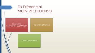 Dx Diferencial
MUESTREO EXTENSO
Pielonefritis
XANTOGRANULOMATOSA
Carcinoma Urotelial
Otros Carcinomas
 