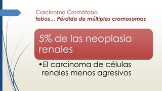 Carcinoma Cromófobo
fobos… Pérdida de múltiples cromosomas
5% de las neoplasia
renales
•El carcinoma de células
renales menos agresivos
 