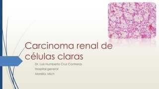 Carcinoma renal de
células claras
Dr. Luis Humberto Cruz Contreras
Hospital general
Morelia, Mich
 