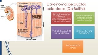 Carcinoma de ductos
colectores (De Bellini)
Se originan de las
células
intercaladas de los
ductos colectores
Ductos colectores :
Terminan en las
papilas renales
MÁS LOCALIZADOS
EN LA MÉDULA
Criterios Dx MAL
DEFINIDOS
PRONÓSTICO
MALO
 
