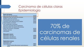 Carcinoma de células claras
Epidemiología
70% de
carcinomas de
células renales
 