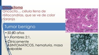 Oncocitoma
Oncocito… célula llena de
mitocondrias, que se ve de color
naranja
Tumor benigno
•50-80 años
•> Hombres 2:1,
•Clínicamente
ASINTOMÁTICOS, hematuria, masa
palpable
 