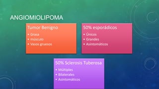 ANGIOMIOLIPOMA
Tumor Benigno
• Grasa
• músculo
• Vasos gruesos
50% esporádicos
• Únicos
• Grandes
• Asintomáticos
50% Sclerosis Tuberosa
• Múltiples
• Bilaterales
• Asintomáticos
 
