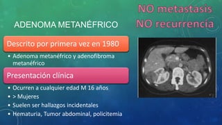ADENOMA METANÉFRICO
Descrito por primera vez en 1980
• Adenoma metanéfrico y adenofibroma
metanéfrico
Presentación clínica
• Ocurren a cualquier edad M 16 años
• > Mujeres
• Suelen ser hallazgos incidentales
• Hematuria, Tumor abdominal, policitemia
 