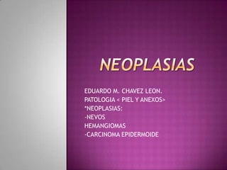 NEOPLASIAS EDUARDO M. CHAVEZ LEON. PATOLOGIA < PIEL Y ANEXOS> *NEOPLASIAS: -NEVOS HEMANGIOMAS -CARCINOMA EPIDERMOIDE 