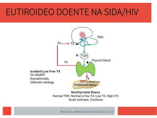 EUTIROIDEO DOENTE NA SIDA/HIV
Rev Endocr Metab Disord 14 (2013): 127-131
 