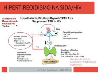 HIPERTIREOIDISMO NA SIDA/HIV
Rev Endocr Metab Disord 14 (2013): 127-131
Pneumocystis jiroveci /
Coccidioides / M. tuberculosis
Cryptococcus
Síndrome de
Reconstituição
Imune (SRI)
Tardia
 
