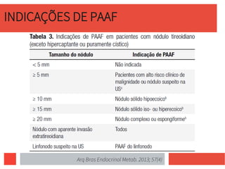 INDICAÇÕES DE PAAF
Arq Bras Endocrinol Metab. 2013; 57(4)
 