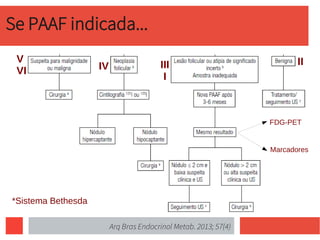 Se PAAF indicada...
Arq Bras Endocrinol Metab. 2013; 57(4)
V
VI
IIIII
I
IV
*Sistema Bethesda
FDG-PET
Marcadores
 