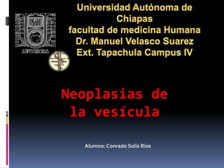 Neoplasias de
 la vesícula

  Alumno: Conrado Solís Ríos
 