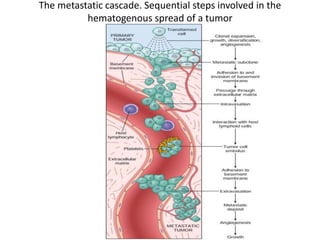 The metastatic cascade. Sequential steps involved in the
hematogenous spread of a tumor
 