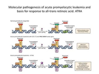 Molecular pathogenesis of acute promyelocytic leukemia and
basis for response to all-trans retinoic acid. ATRA
 