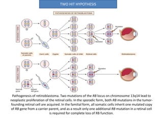 Pathogenesis of retinoblastoma. Two mutations of the RB locus on chromosome 13q14 lead to
neoplastic proliferation of the retinal cells. In the sporadic form, both RB mutations in the tumor-
founding retinal cell are acquired. In the familial form, all somatic cells inherit one mutated copy
of RB gene from a carrier parent, and as a result only one additional RB mutation in a retinal cell
is required for complete loss of RB function.
TWO HIT HYPOTHESIS
 