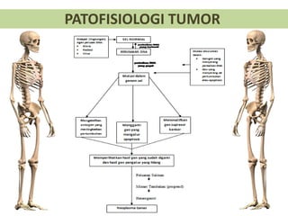 PATOFISIOLOGI TUMOR
 