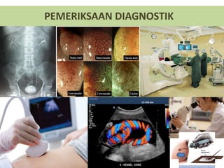 PEMERIKSAAN DIAGNOSTIK
 
