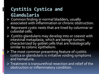 Cystitis Cystica and 
Glandularis 
 Common finding in normal bladders, usually 
associated with inflammation or chronic obstruction. 
 Represent cystic nests that are lined by columnar or 
cuboidal cells. 
 Cystitis glandularis may develop into or coexist with 
intestinal metaplasia, which are benign tumors 
characterized by goblet cells that are histologically 
similar to colonic epithelium. 
 The most common presenting feature of cystitis 
cystica or glandularis is irritative voiding symptoms 
and hematuria. 
 Treatment is transurethral resection and relief of the 
obstruction or inflammatory condition. 
 