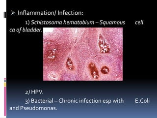  Inflammation/ Infection: 
1) Schistosoma hematobium – Squamous cell 
ca of bladder. 
2) HPV. 
3) Bacterial – Chronic infection esp with E.Coli 
and Pseudomonas. 
 
