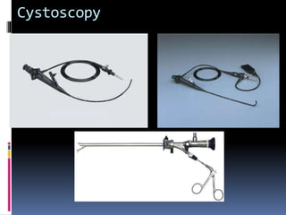 Cystoscopy 
 