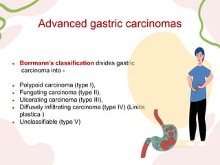 Boreman Classification neoplasm of stomach 5th edition of who classification by Dr Yogeeta ...