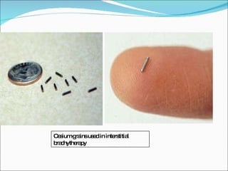 Cesium grains used in interstitial brachytherapy 