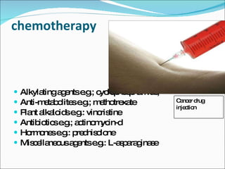 chemotherapy Alkylating agents e.g.; cyclophosphamide, Anti-metabolites e.g.; methotrexate Plant alkaloids e.g.: vincristine Antibiotics e.g.; actinomycin-d Hormones e.g.: prednisolone Miscellaneous agents e.g.: L-asparaginase Cancer drug injection 