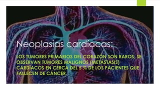 Neoplasias cardíacas: 
LOS TUMORES PRIMARIOS DEL CORAZÓN SON RAROS, SE 
OBSERVAN TUMORES MALIGNOS (METÁSTASIS) 
CARDÍACOS EN CERCA DEL 5 % DE LOS PACIENTES QUE 
FALLECEN DE CÁNCER. 
 