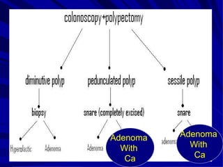 Neoplastic Colonic Polyp | PPT