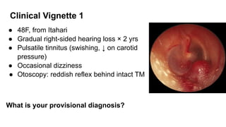 Neoplastic Diseases of Middle & Inner Ear (Glomus Tumour & Acoustic ...